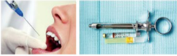 胰島素，牙科麻醉6.png